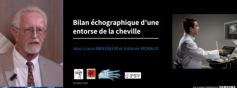 Mise au point préchirurgicale d'une lésion ligamentaire de la cheville