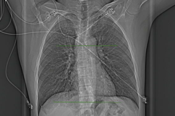 Le cardiologue doit-il interpréter seul le coroscanner ?